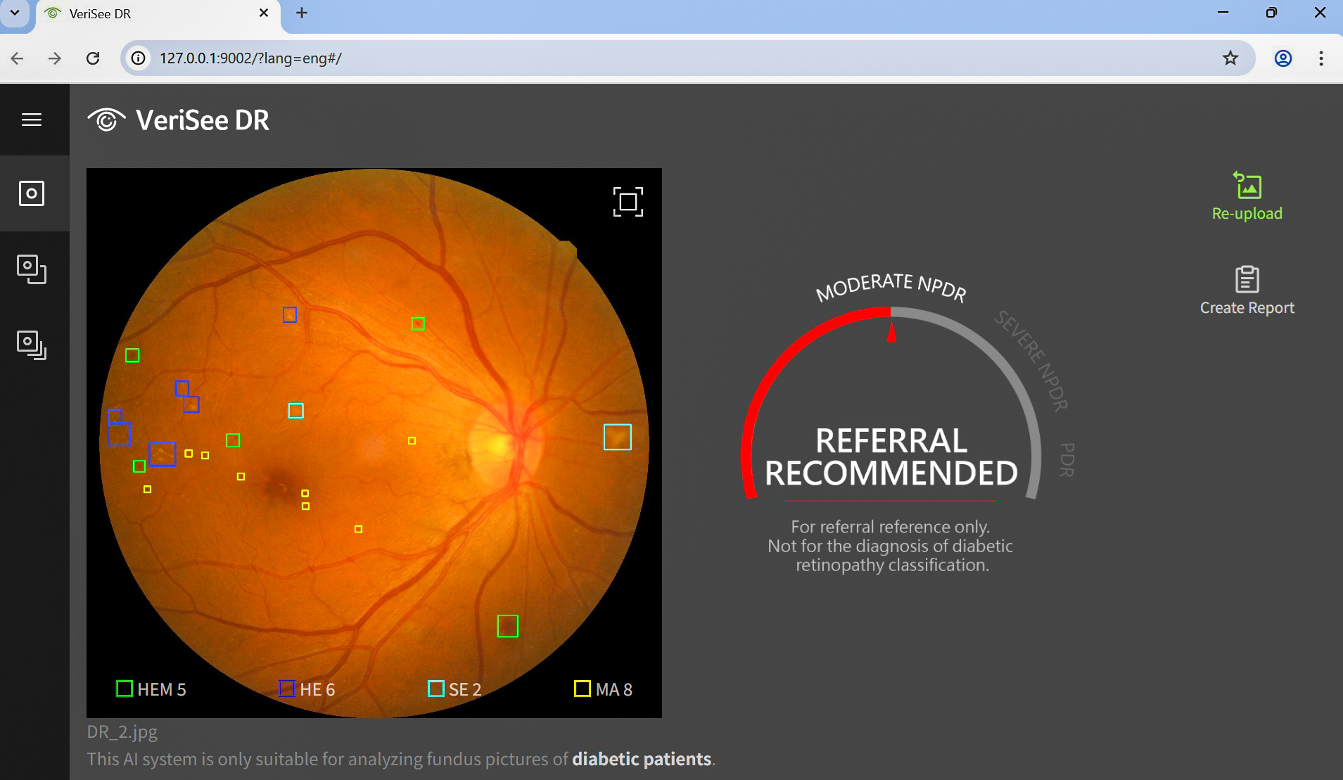A screen capture shows the Acer Medical VeriSee DR solution. It